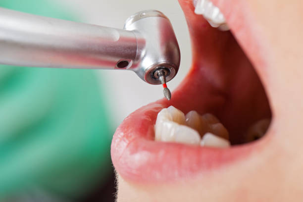 Best Emergency Denture Repair in Ahoskie, NC